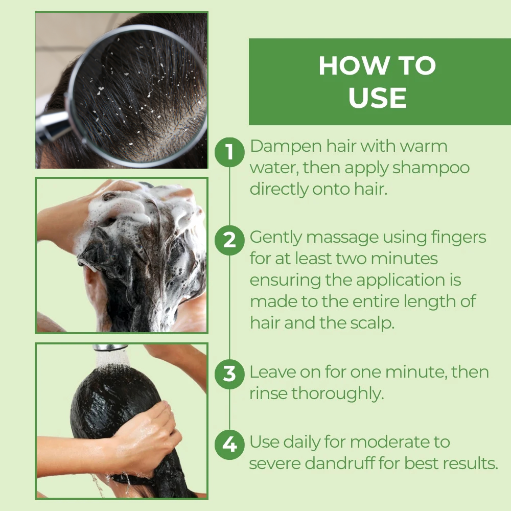 Cillo Anti-Dandruff Conditioner – 400ml for a Flake-Free, Hydrated Scalp